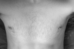 xx