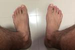 Feets