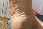 Soles