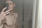 abs