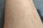 Thigh