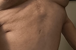 allen — Chest