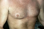 hot ben โ Chest