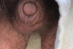 Smallest penis Mike