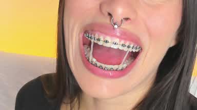 Braces black elastic