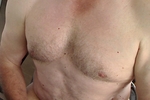 Pec shot