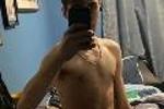 Bulging