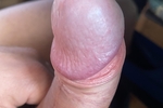 close dick