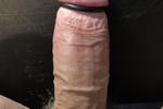 penis