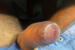 🤍PRECUM🤍