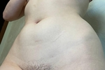 my body
