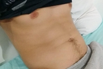 abs