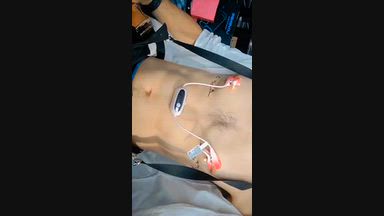 torturing nipples