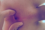 anal 1