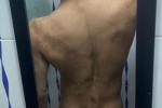Boody