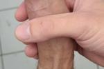 Dick