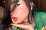 Anni_acker_b
