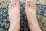 Feet