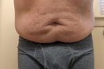 prostateaddict1983 โ Package
