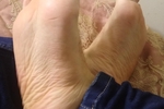 FEET