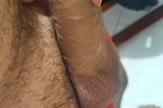 dick