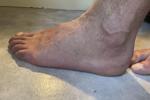 feet