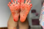 Jelly on my feet