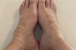 Feet