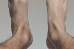 Feet