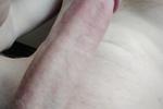 penis
