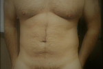 frank — My body