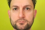 My fucking face