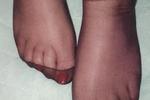 nylon feet