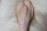 Soft cock