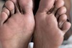 Feet