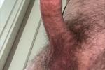 Penis