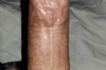 Cock Shot