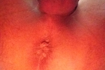 Butthole