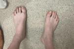 Feet
