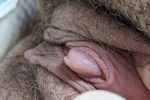 Swollen clit
