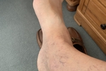 feet