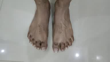 Bare Feet 2