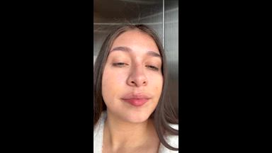My braces on a normal day in my life