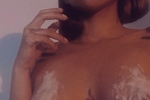 Bite me