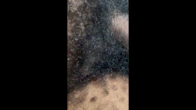 pubic hair