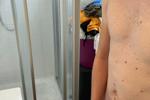 Shower / Towel tease set