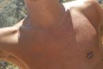 MINIPPLES - Solo Beach - Pierced