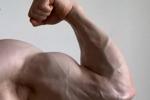 VENOUS BICEP