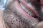 Me