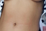 Tits